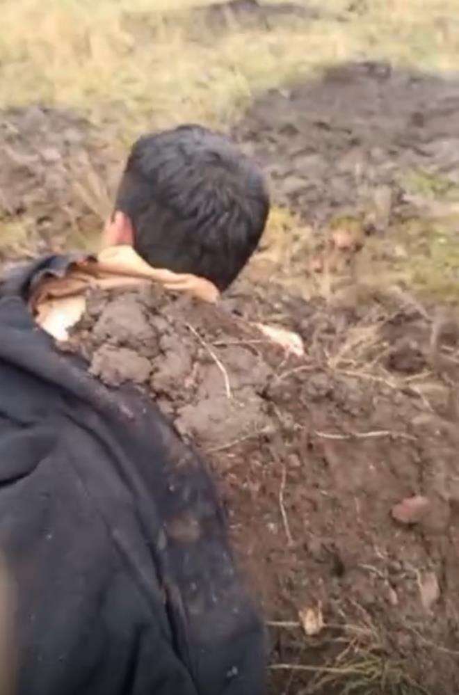 Iğdır'da yıldırım düşmesi sonucu, 2 kardeş yaralandı 20 koyun telef oldu