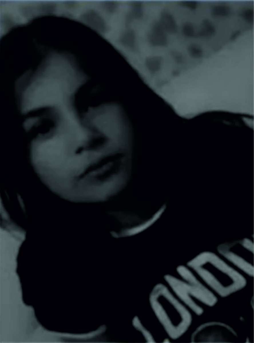 K&ouml;peklerin saldırısına uğrayan 12 yaşındaki &ccedil;ocuk hayatını kaybetti