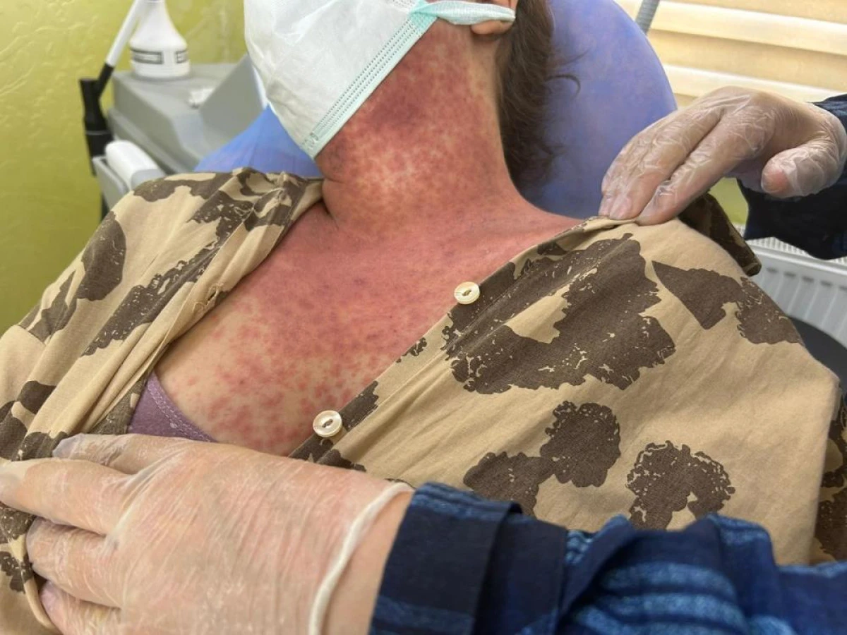 Van'da ‘beyazlatıcı krem' faciası: 4 kişi hastanelik oldu