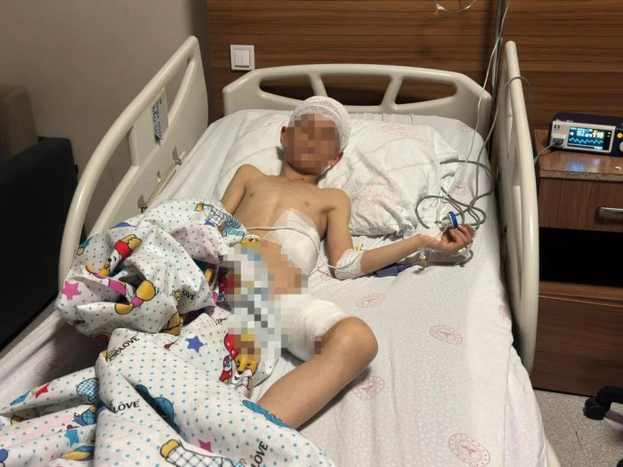 Van&rsquo;daki k&ouml;pek dehşetinde kan donduran detaylar