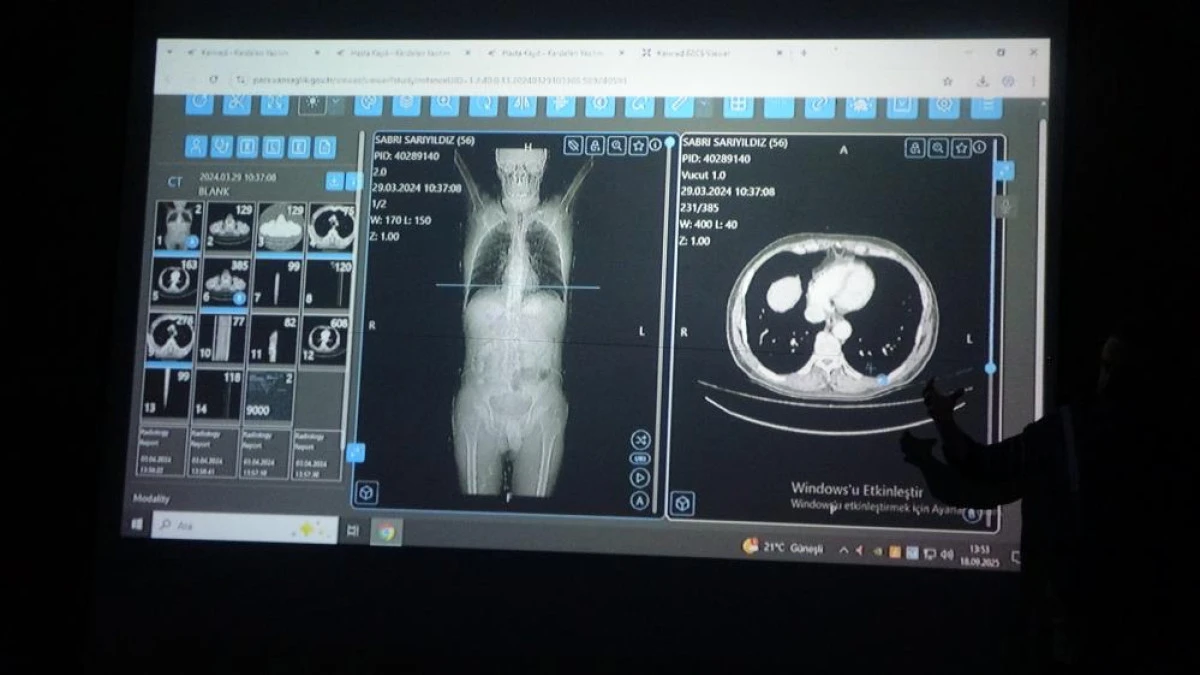 Van'dan dünyaya örnek çalışma: Kanser tedavisinde yapay zekâ kullanıldı